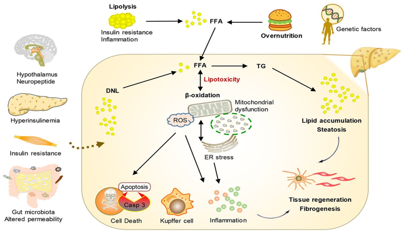 Conceptual diagram of the pathogenesis of MASLD. This diagram illustrates the complex interplay between overnutrition, insulin resistance, and mitochondrial dysfunction leading to hepatic fibrogenesis. Key drivers include the gut-liver axis (altered permeability), hypothalamic neuropeptide signaling
