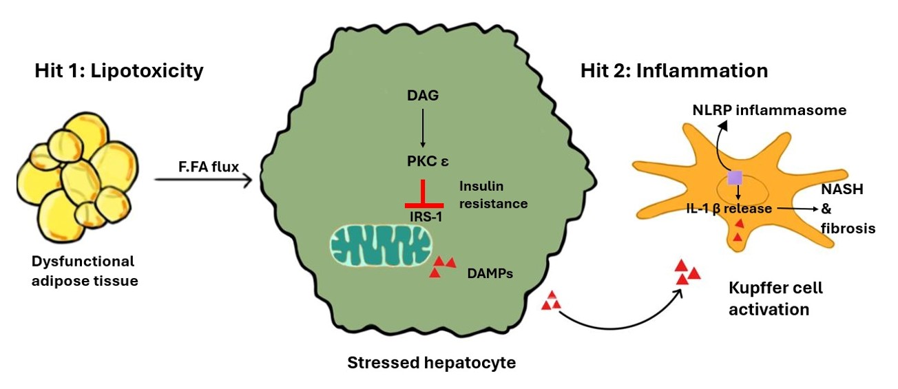 Multiple-Hit Pathogenesis. This illustration highlights how metabolic lipotoxicity (Hit 1) leads to innate immune activation, hepatocyte stress, and subsequent inflammation (Hit 2). Acronyms: DAG, diacylglycerol; DAMPs, damage-associated molecular patterns; IRS-1, insulin receptor substrate 1; NLRP3