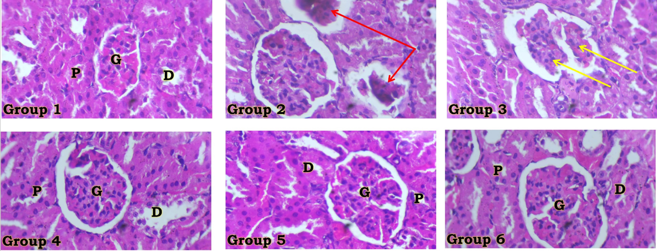 Effects of ABALE on Kidney Histology of Wistar Rats with CsA-induced Nephrotoxicity (magnification = x400) G = Glomerulus; P = Proximal tubule; D = Distal tubule; Red Arrow = Atrophic glomerulus; Yellow Arrow = Shrunken glomerulus.
