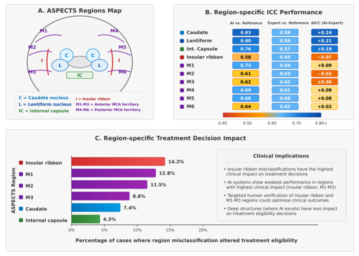 Region-specific Analysis of AI vs Human Performance in ASPECTS Scoring.