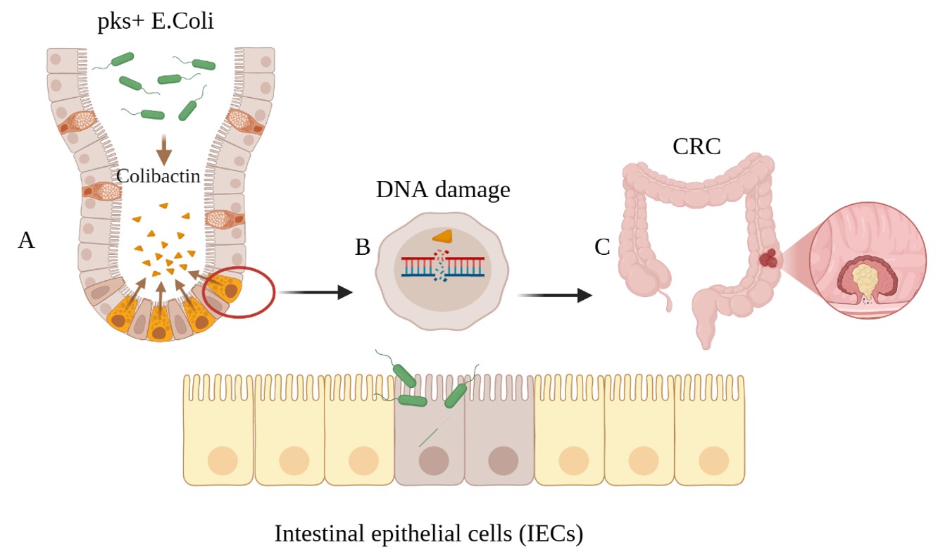 A general illustration of CRC development by induction of pks^+ Escherichia coli.