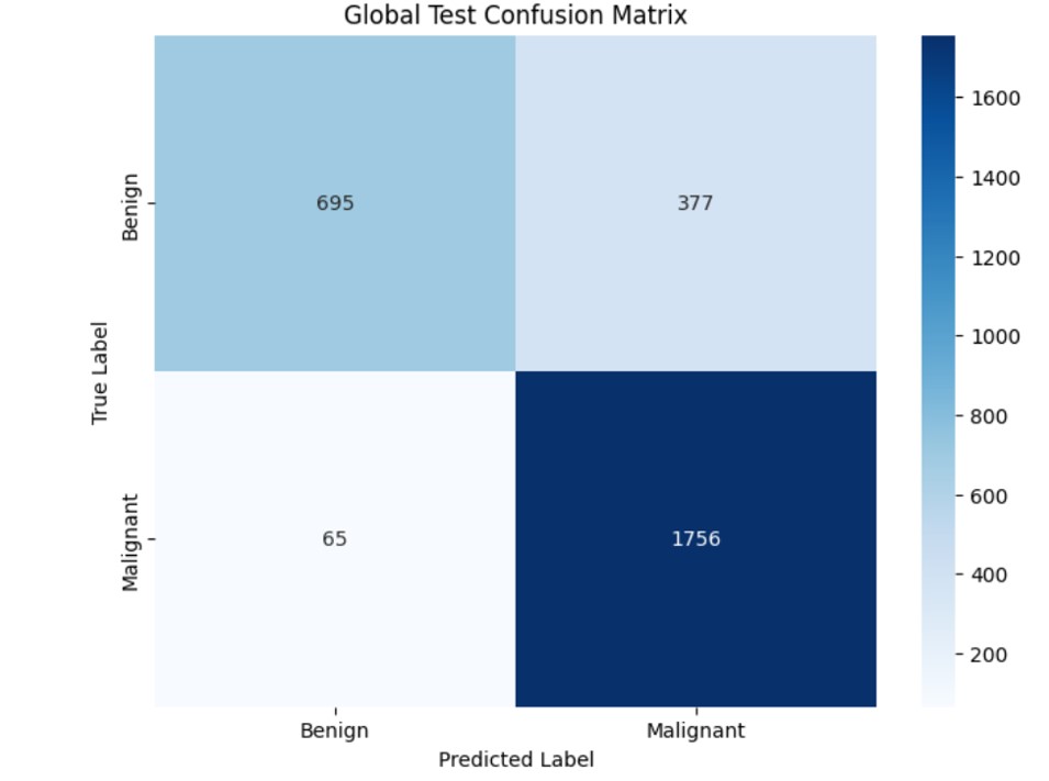Confusion matrix of the final global federated model evaluated on the aggregated test set.