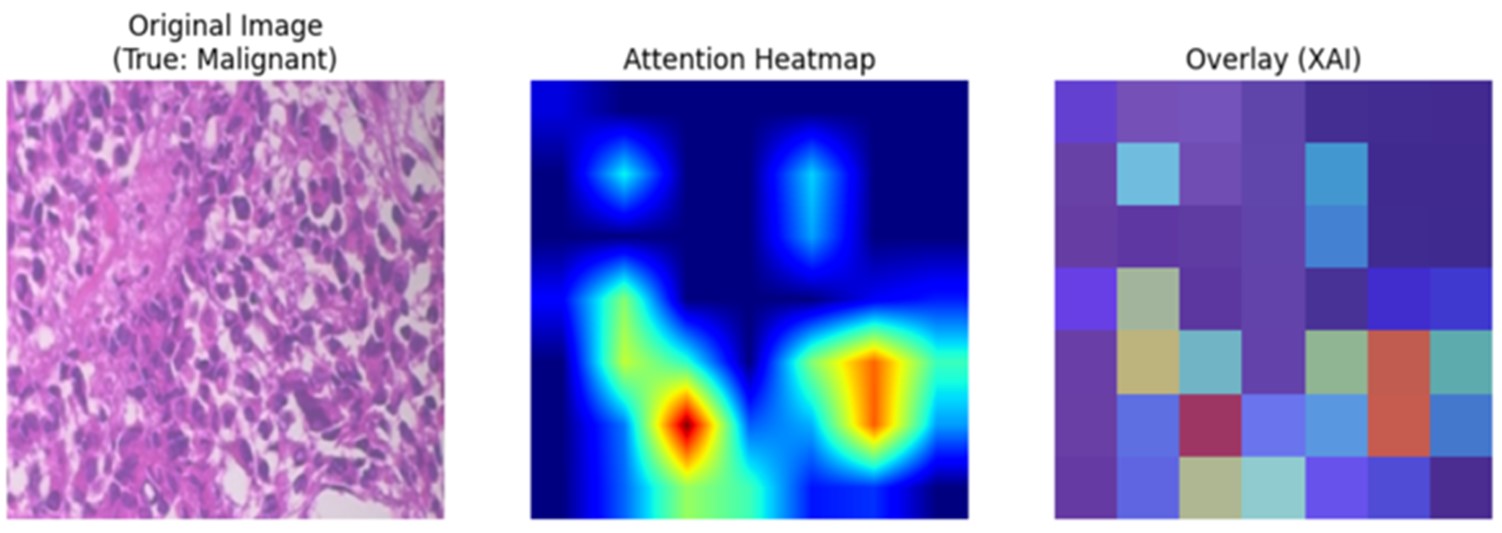 Gradient-based explainability maps for representative test samples: (a) true positive, (b) false positive, and (c) false negative predictions.